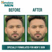 Picture of Himalaya Men Pimple Clear Neem Face Wash 50ml